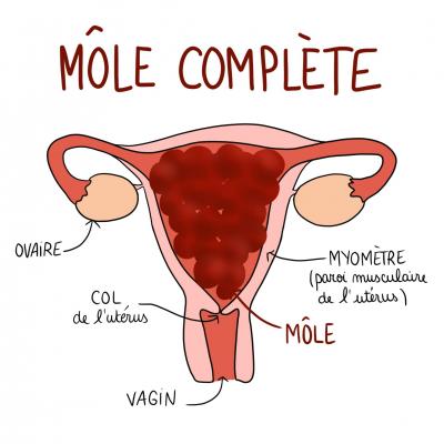 Mole complete