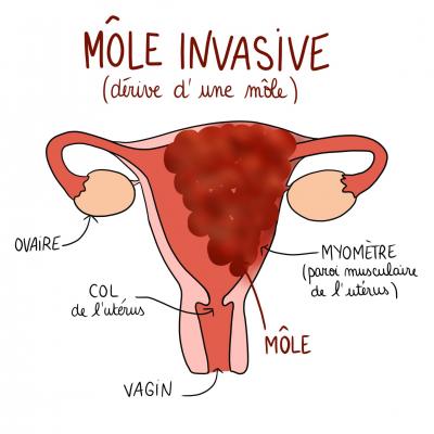 Mole invasive